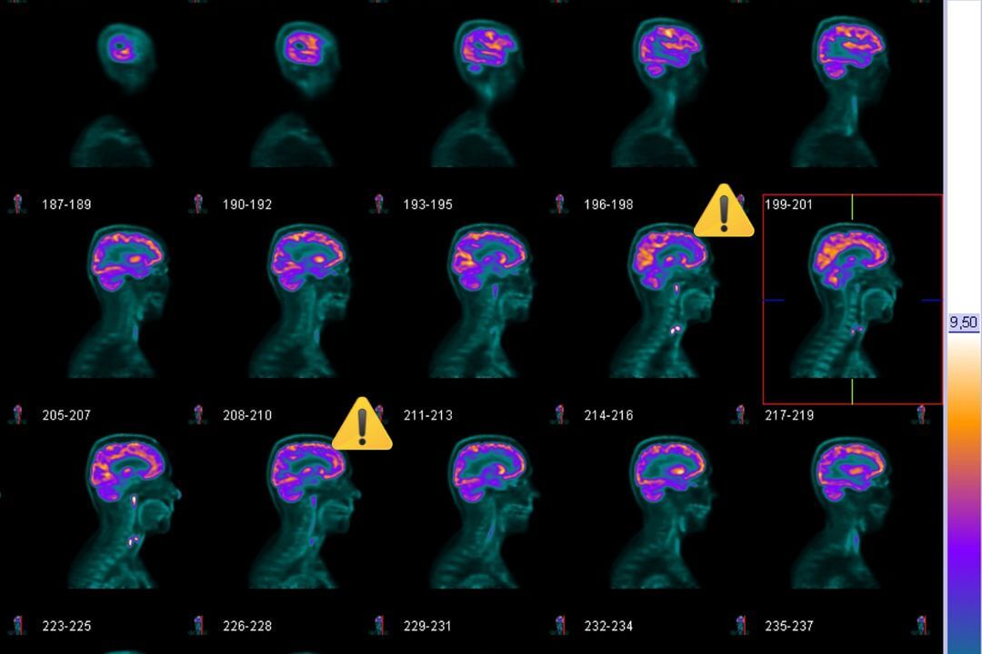 Ghidurile BrainMap - ghiduri practice pe afecțiuni