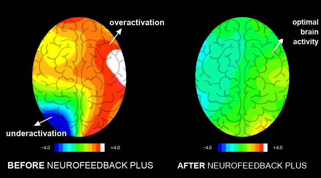 Brain activity before and after brain training
