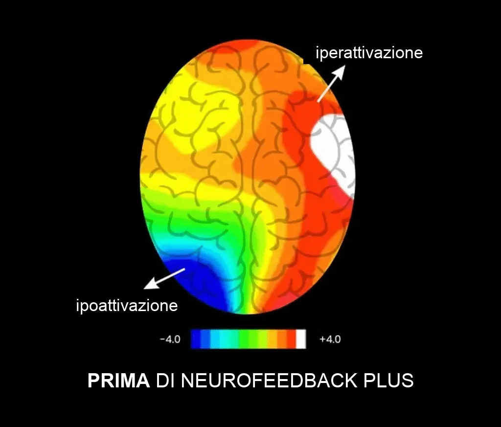Prima